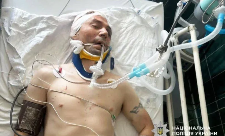У Костополі мотоцикліст збив велосипедиста на пішохідному переході, поліція встановлює особу потерпілого